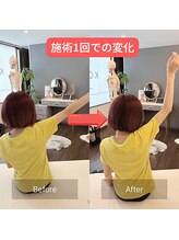 整体 寿 立川院(KOTOBUKI)/立川/整体/肩こり/腰痛/美容整体