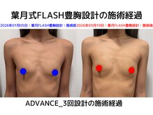 セブンシーズ 上野店(Seven Seas)/バストアップ/豊胸/東京都/上野