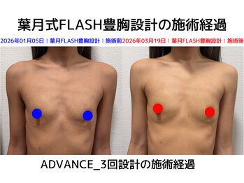 セブンシーズ 上野店(Seven Seas)/バストアップ/豊胸/東京都/上野