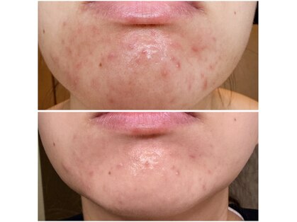 カルム(Calme)の写真