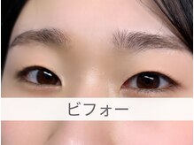 シロイトビラ 熊本銀座通り(SHIROI TOBIRA)/ビフォー