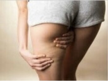 ヨサパーク ハーブCOCO和 北名古屋店(YOSA PARK)/◇太もも◇