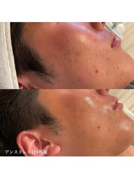 エクラ(eclat)/クリスティーナ／アンストレス