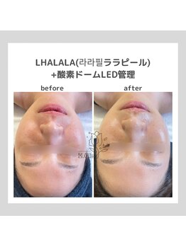 ポムハヌル(pom.haneul)/韓国肌管理室