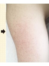 ノットノット 自由が丘(Not Knot)/２.グリーンピールボディ  1回後