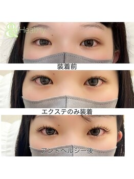 サンライズ(SUNRISE)/