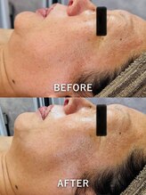 ルーク(Luke)/毛穴・しわ・くすみケア