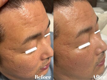 サロンビー 赤坂(SalonB)/男性にも人気！美肌コース