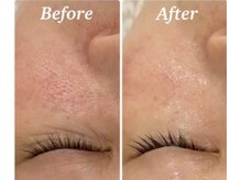 ラボーテ(La Beaute)/