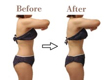 フィオーレ 麻布十番(Fiore)/背中とくびれの変化でドレス映え