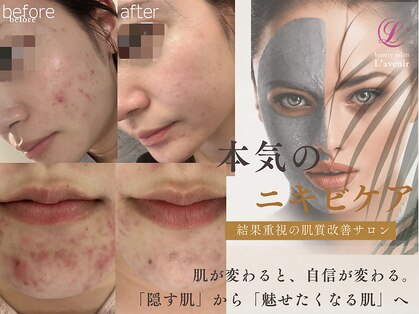 ラヴニール(L'avenir)の写真