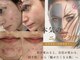 ラヴニール(L'avenir)の写真