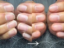 ホロムア(Holomua)の雰囲気（ケアからの土台作りに趣を置く事で美しさを実感◎強度upフォルム）