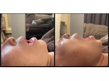 ツキミ コスメティックス(TSUKIMI cosmetics)の雰囲気(口腔ケアで表情筋を育て、美しく健康に!(3回施術))