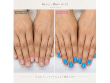 ビューティーフロア ビビット サロンアンドスクール(BEAUTYFLOOR vivid salon&school)の雰囲気（乾燥やささくれのお悩みにも保湿ケアジェルの仕方によって改善）