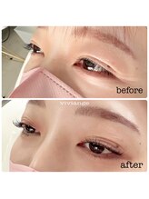 ヴィヴィアンジュ(viviange)/ラッシュリフト