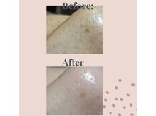 インフィニティ(INFINITY)/お鼻のザラつき対策に♪