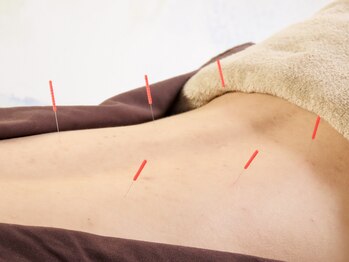 イーライフ鍼灸接骨院/腰の痛みに徹底的にアプローチ！