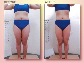 ジュリア オージェ 天王寺店/ビフォーアフター（ターゲット)