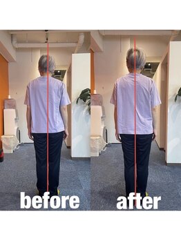 カワル整体 上通り院/【外反.母趾でお困りのお客様】