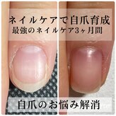 アミカ ネイル(amica nail)