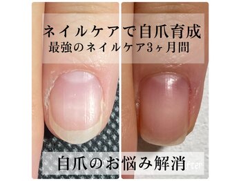 アミカ ネイル(amica nail)