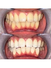 ライトビューティー 池袋店(LightBeauty)/症例写真