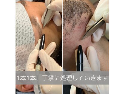 プライベートエルサ(Private Elsa)の写真