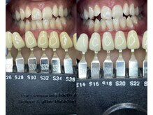 トウキョースワーズ 渋谷店(TOKYO SWRS)/#ホワイトニング #渋谷 #池袋