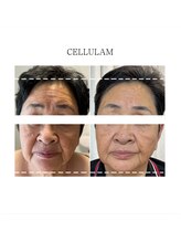 セル ノ ネ(Cell ne)/エイジリバース