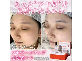 ビオトナス(Facial Esthe)/ララピール+エクソソーム