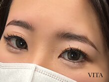 ヴィータ(VITA)/ハリウッドブロウリフト