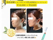 エステサロン ジュエル 高松レインボー店(JEWEL)