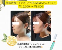 エステサロン ジュエル 高松レインボー店(JEWEL)