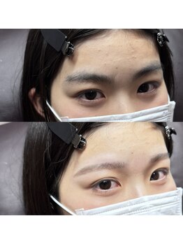 ブリス 姫路(Bliss)/お客様Before/After