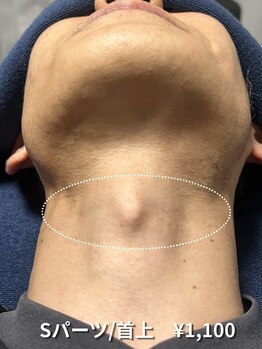 カナウ(KANAU)/【Sパーツ/脱毛】首上（喉仏）