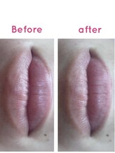 リッシュ(Riche)/唇パック