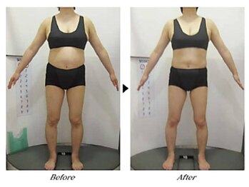 ビューティークリニックコダマ 小林店/【1か月コース】F.N様(45歳)