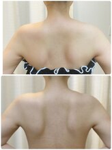 ティアエ(T-ae)/【ブライダルエステ】