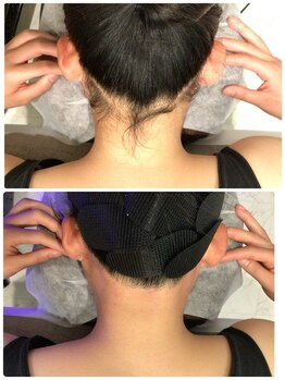 ビープラス(B plus)/効果長持ちうなじMIX脱毛☆