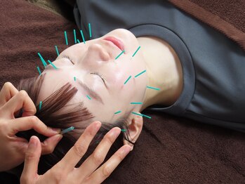 リベルテ(liberte)/初回の流れ　美容鍼