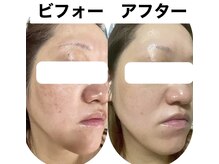 フルール(fleur)の雰囲気（ヒト幹細胞導入コース！シミシワたるみなど若々しいお肌に！）