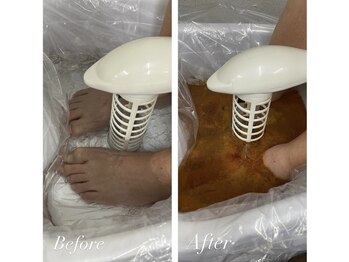 エムズビューティーサロン(M's Beauty Salon)/【4】Before After