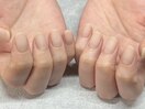 自爪風ネイル