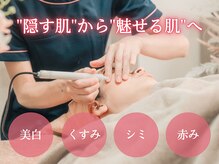 フローラ(Flora)