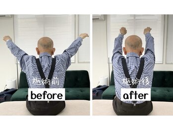 沼田整体スタジオ/施術ビフォーアフター（肩）