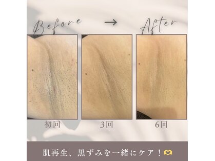 モア トゥインクル 緑井店(MORE twinkle)の写真