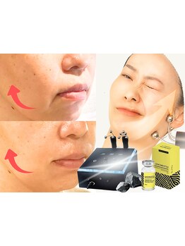 ホウレイ線・たるみ改善！予防ケア