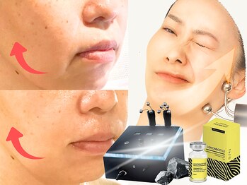 ナイア(naia)の写真/顔ぎゅんっ!で話題の《テラボーラー》×脂肪分解《レモンボトル》で脂肪&たるみ改善、エイジングケアに◎