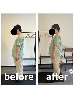 熊本カワル整体 JR上熊本駅院/姿勢変化